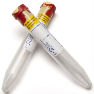Tubo BD Vacutainer para Uroanálisis con Preservante 8ml (1 Caja 100 Unid.)